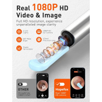 Отоскоп Hopefox для удаления ушной серы, 1080P HD с камерой и 6 светодиодами (my-19176)