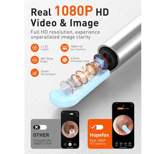 Отоскоп Hopefox для видалення вушної сірки, 1080P HD з камерою та 6 світлодіодами (my-19176)