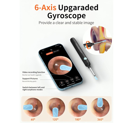 Отоскоп Hopefox для видалення вушної сірки, 1080P HD з камерою та 6 світлодіодами (my-19176)