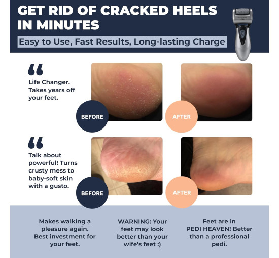 Электрическое устройство Own Harmony CR900 для педикюра с 3 роликами, серый (my-20127)