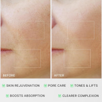 Микротоковая терапия для лица VRAIKO RM MediCube,  для домашнего ухода за кожей, жемчужно-белый (my-20059)