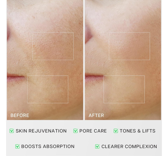 Микротоковая терапия для лица VRAIKO RM MediCube,  для домашнего ухода за кожей, жемчужно-белый (my-20059)