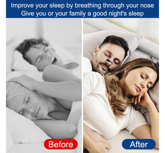 Назальні смужки SKKAEO (my-20086)