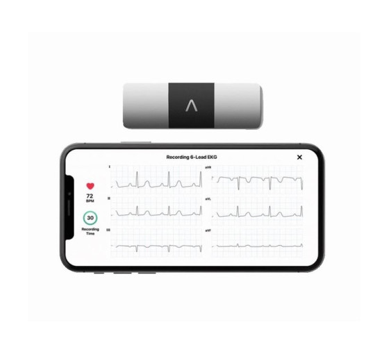 Портативный электрокардиограф AliveCor KardiaMobile 6L AC-019-NUA-A (my-20035)