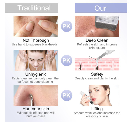 Ультразвуковий відлущувальний прилад ANLAN CPJ07-02 з іонами, білий (my-20116)