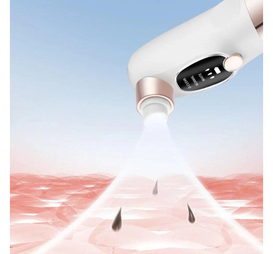 Вакуумний прилад UKC для гідропілінгу та масажу обличчя (my-20078)