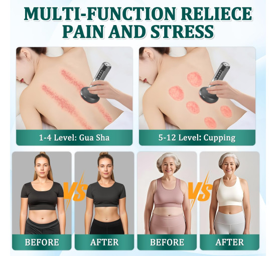 Вакуумний електричний масажер Xinrongda XY-CM, сірий (my-21128)