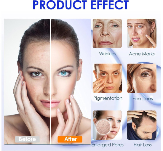 Сменные картриджи Lazzybeauty Dr.pen Ultima A6 с 12 иглами для микронидлинга (my-21168)