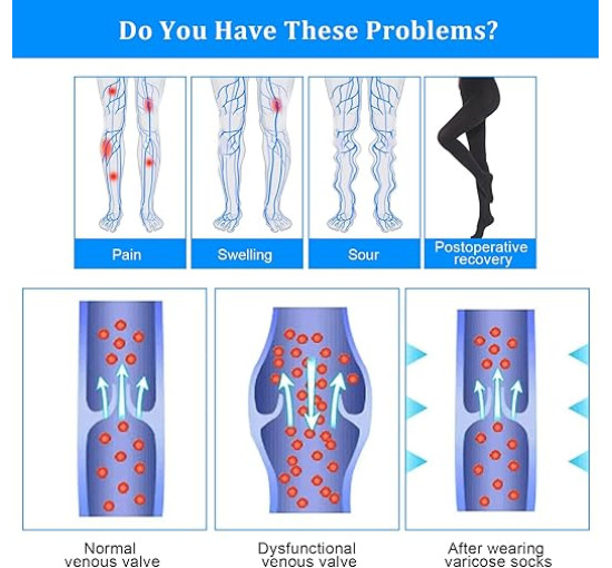 Компресійні колготки AOGOE для жінок і чоловіків, 23-32 мм рт. ст., клас 2, закритий носок, компресійні колготки, XL чорний (0145)