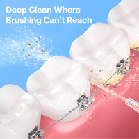 Іригатор Bitvae C5 для комплексного догляду за ротовою порожниною фіолетовий (my-17220)